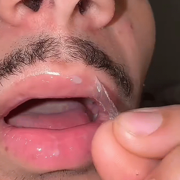 EVIVNA™